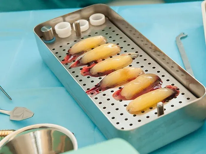 Metal surgical tray holding six yellow gel-like strips, beside dental instruments on a blue drape