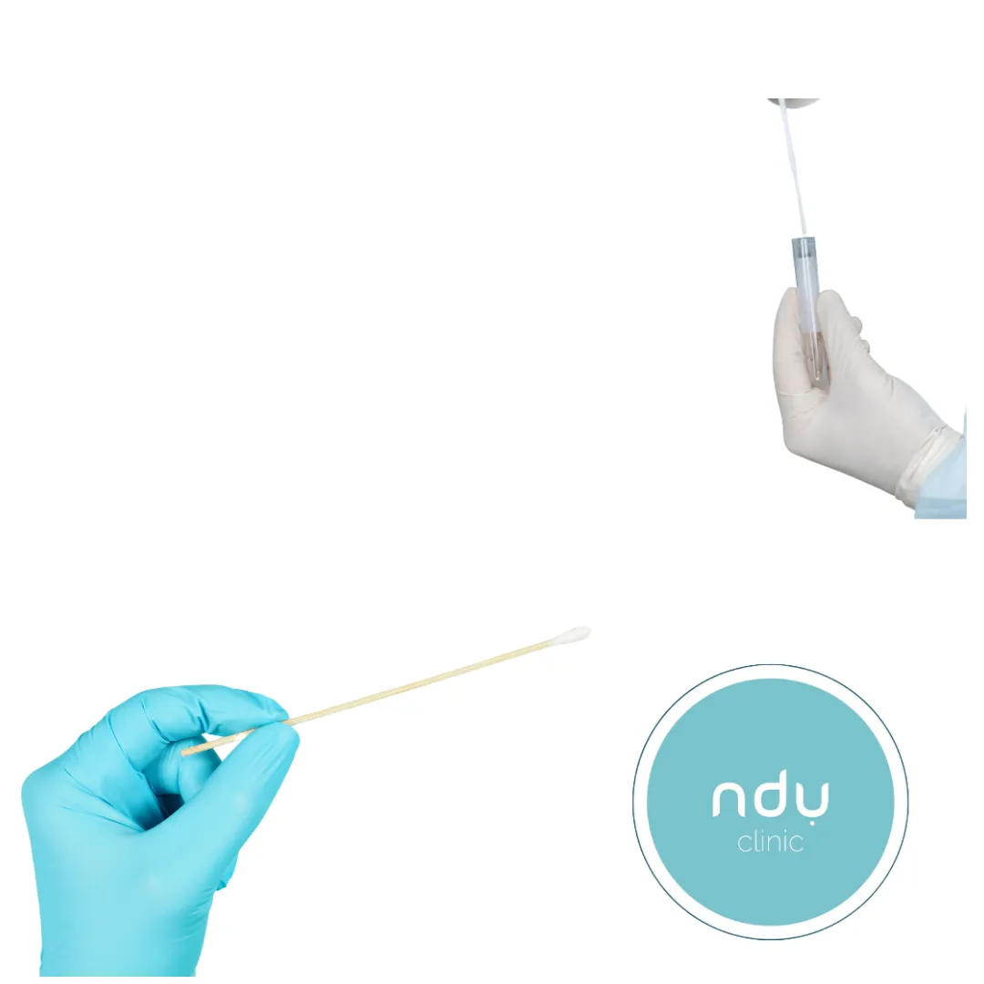 Gloved hands holding a cotton swab and a sample tube, with the ndu clinic logo
